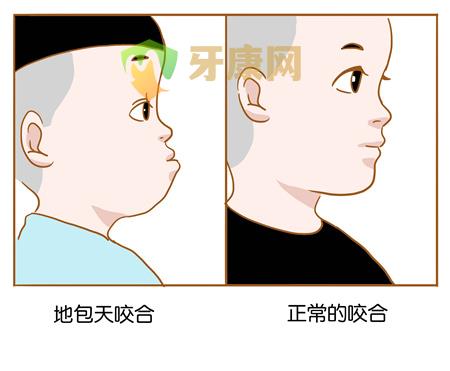 小孩子乳牙不整齐有什么影响？需要进行矫正吗？