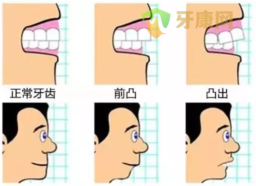 大学生做牙齿矫正什么方法比较好