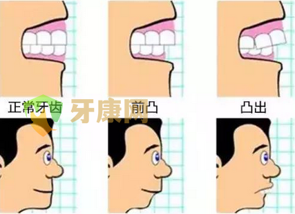 牙周病**能做牙齿矫正吗