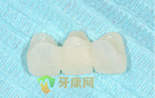 种植牙手术后可以直接戴上临时假牙吗？