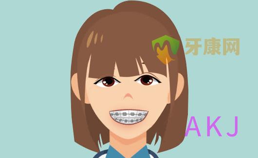 正畸