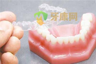 牙齿矫正要多久