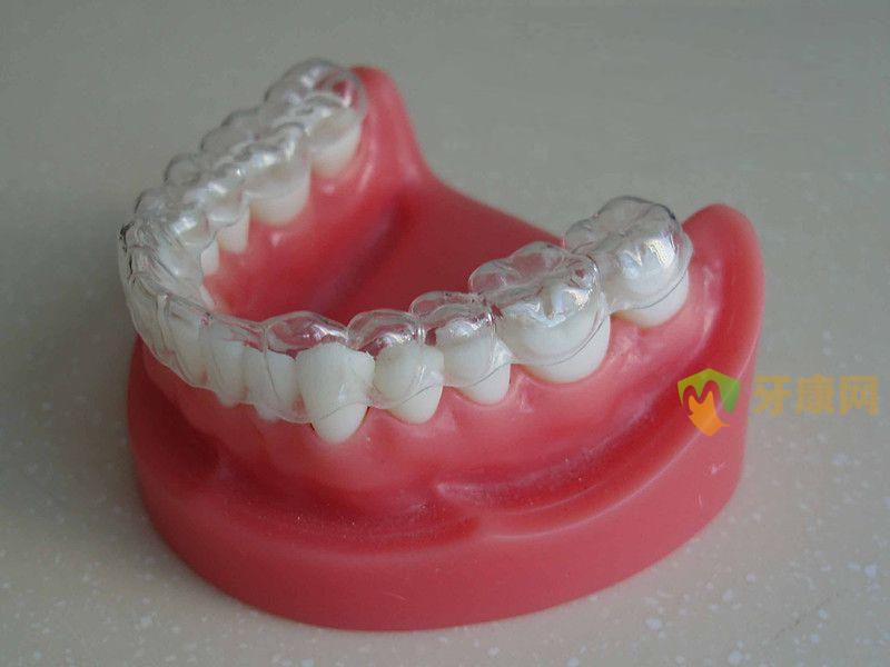 常见的牙齿矫正器有哪些