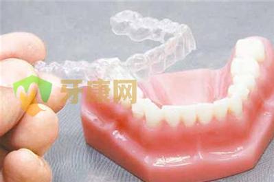 牙齿矫正多久不用戴保持器