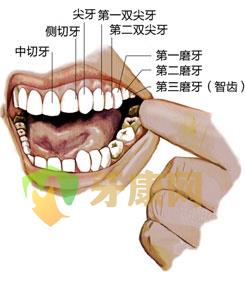  牙齿矫正磨牙（片切）好还是拔牙好？