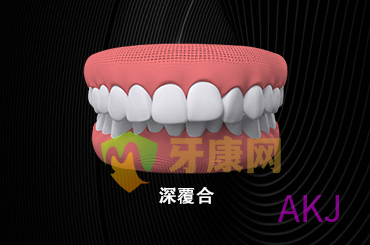 深覆合