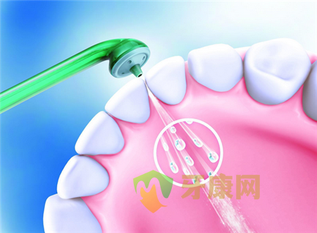如何避免洗牙时牙齿敏感