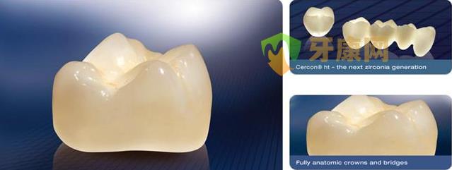 泽康（cercon）氧化锆全瓷牙有什么优势？