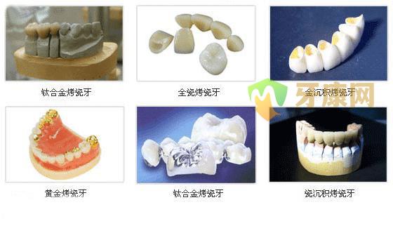 深圳镶牙材料和价格表