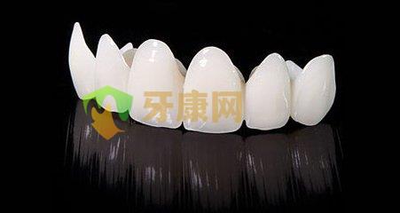 比较好的全瓷牙是二氧化锆全瓷牙吗？