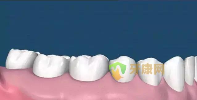 健康牙周