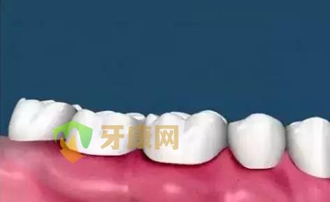 牙龈红肿