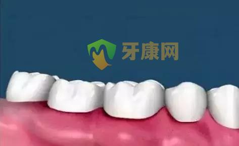 牙龈红肿