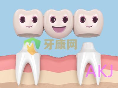 烤瓷牙