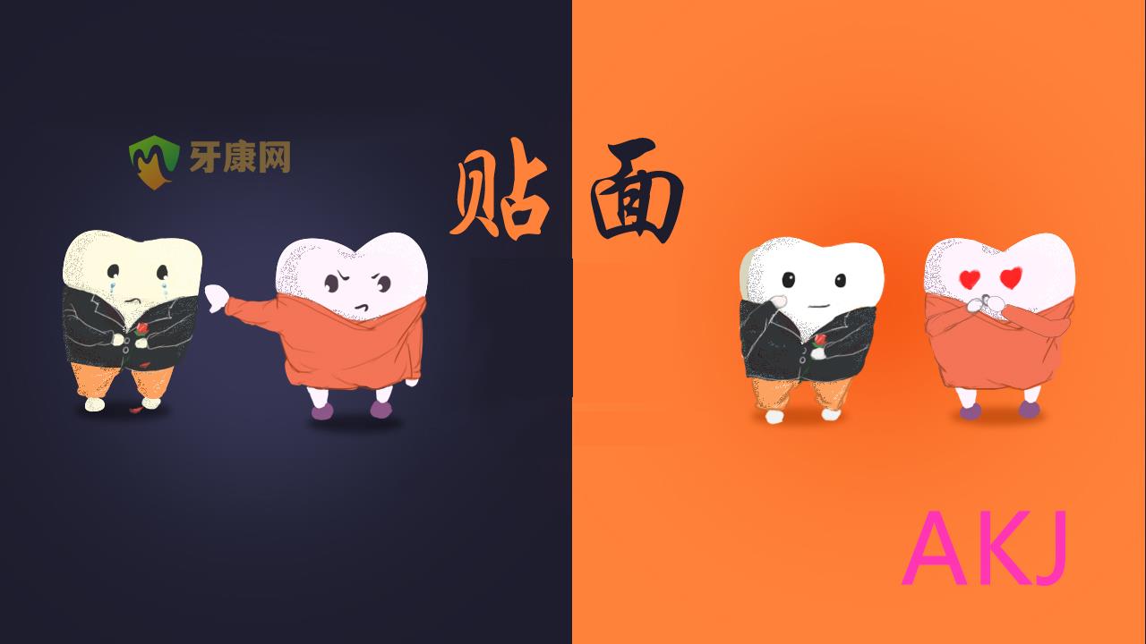 牙贴面