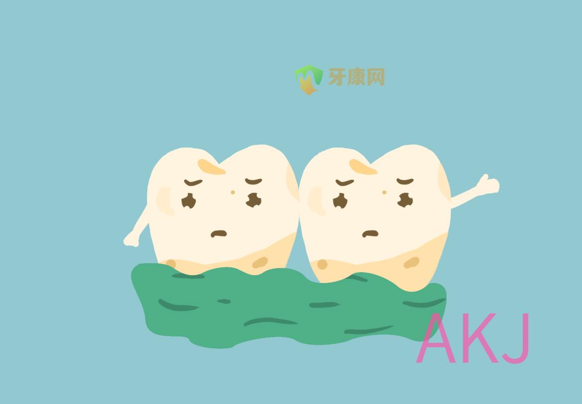 牙结石
