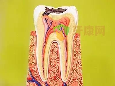 蛀牙可以做根管治疗吗？