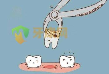 拔牙