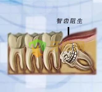 一半是多少