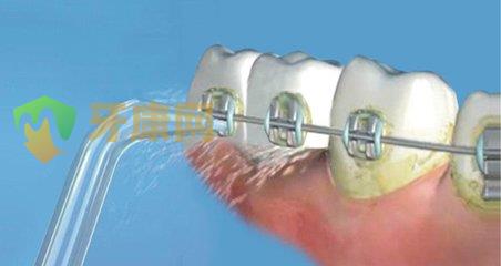 牙龈下刮治后出血正常吗？