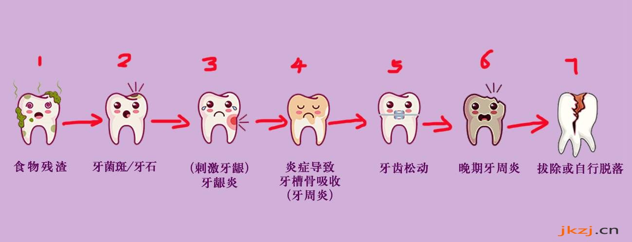 无论有没有好好刷牙,都需要洗牙