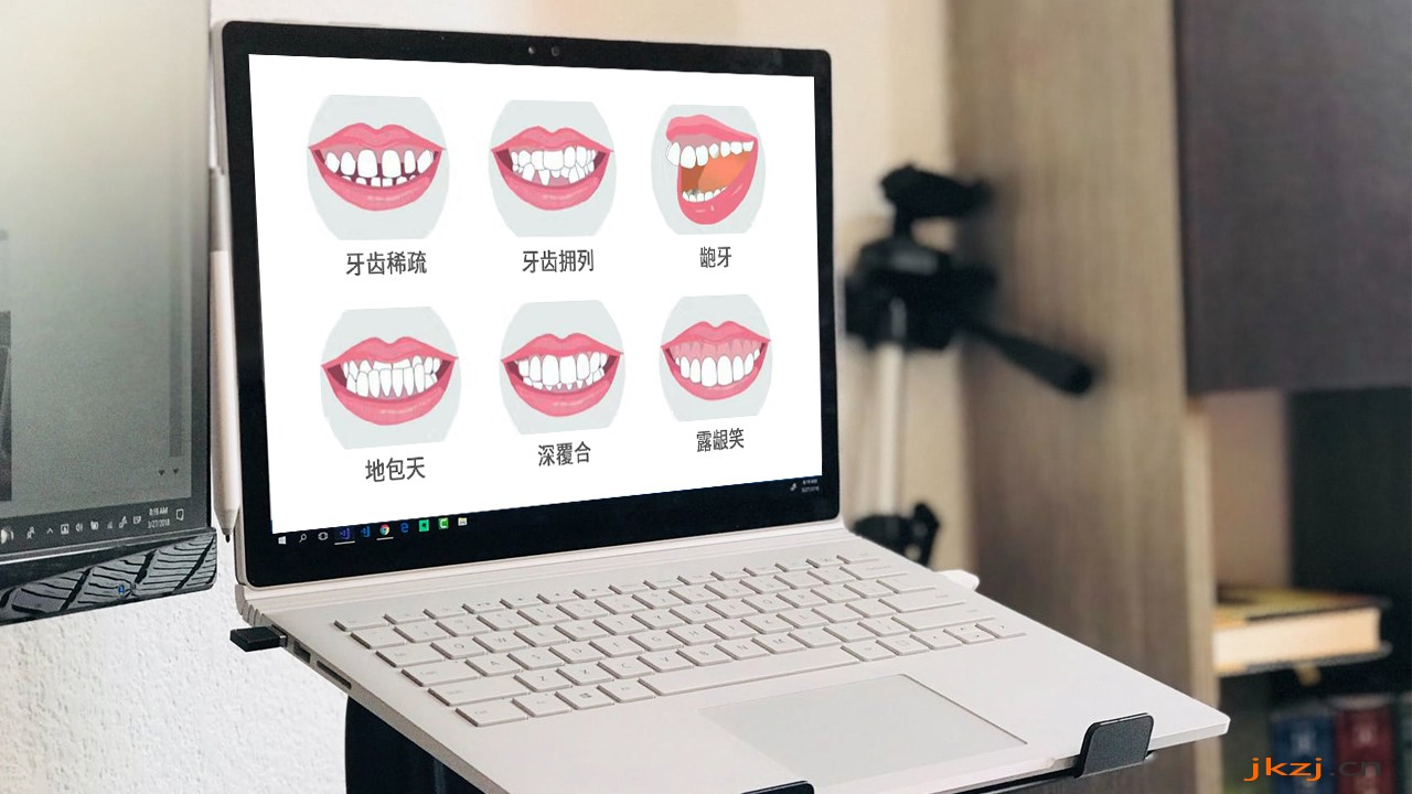 牙齿矫正 牙齿矫正