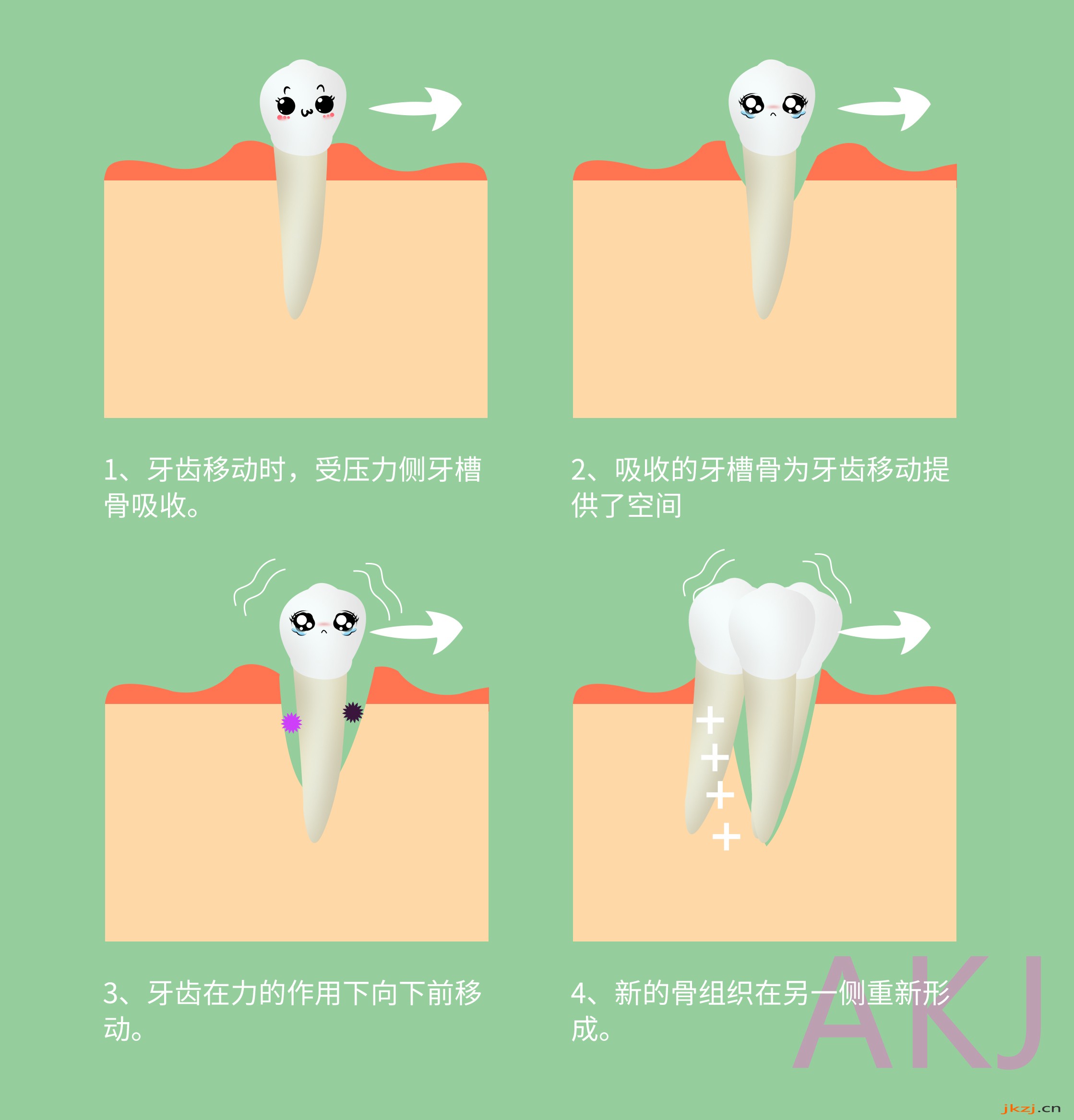 牙齿矫正过程 牙齿矫正过程