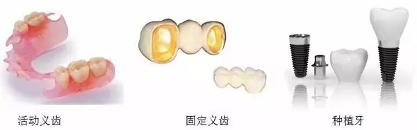 假牙修复大pk,即刻种植牙一招制胜?