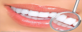 牙康网-根管治疗术后护理