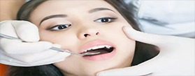 牙康网-补牙镶牙护理